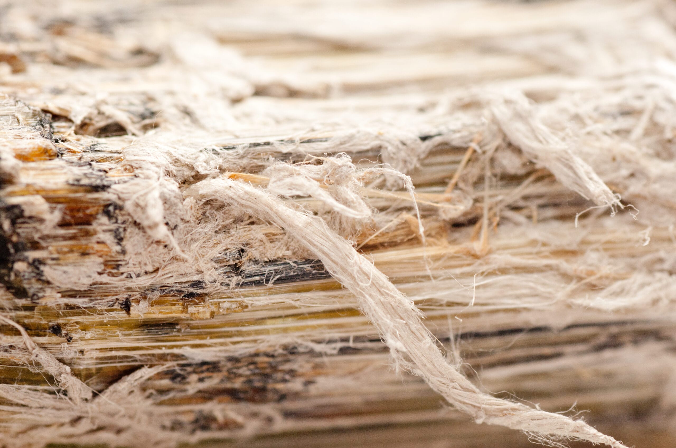 Understanding Epithelioid Mesothelioma: Symptoms, Treatment, and Legal Options